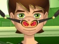 Juego Ben 10 Nose Doctor