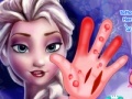 Juego Frozen. Hand surgery