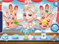 Juego Frozen Elsa Hand Doctor