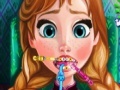 Juego Anna Tooth Injury