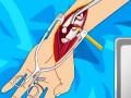 Juego Arm surgery 2