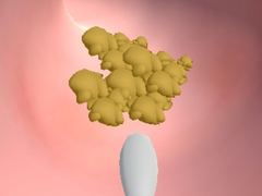Juego Earwax Clinic