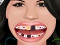 Juego Selena Gomez Perfect Teeth 